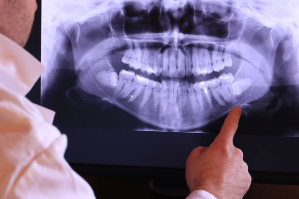 Best Broken or Cracked Tooth Emergency Dentist in Schofield Barracks, HI
