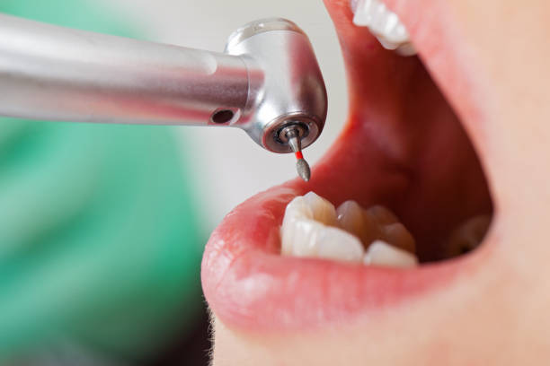 Best Emergency Dentist for Knocked-Out Tooth in Schofield Barracks, HI